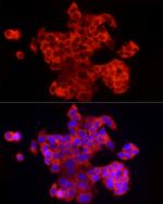 EIF4A1/EIF4A2/EIF4A3 Antibody in Immunocytochemistry (ICC/IF)