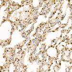 EIF4A1/EIF4A2/EIF4A3 Antibody in Immunohistochemistry (Paraffin) (IHC (P))