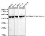 EIF4A1/EIF4A2/EIF4A3 Antibody in Western Blot (WB)