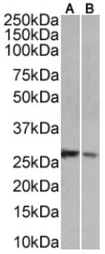 NKG2D Chimeric Antibody in Western Blot (WB)