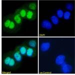 p53 Chimeric Antibody in Immunocytochemistry (ICC/IF)