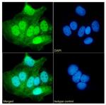 UBE2C Antibody in Immunocytochemistry (ICC/IF)