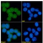 S100A9 Antibody in Immunocytochemistry (ICC/IF)