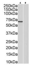 Protein C Antibody in Western Blot (WB)