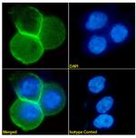 Desmoglein 3 Antibody in Immunocytochemistry (ICC/IF)