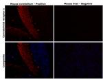 Cannabinoid Receptor 1 Antibody in Immunohistochemistry (Paraffin) (IHC (P))