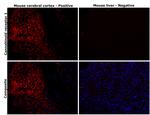 Cannabinoid Receptor 1 Antibody in Immunohistochemistry (Paraffin) (IHC (P))