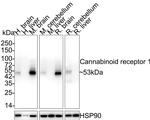 Cannabinoid Receptor 1 Antibody in Western Blot (WB)