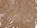 GP130 Antibody in Immunohistochemistry (Paraffin) (IHC (P))