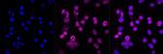 ROCK1 Antibody in Immunocytochemistry (ICC/IF)