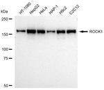 ROCK1 Antibody in Western Blot (WB)