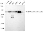 DNMT3A Antibody in Western Blot (WB)