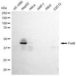 FosB Antibody in Western Blot (WB)