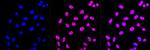 CPEB1 Antibody in Immunocytochemistry (ICC/IF)