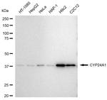 CYP24A1 Antibody in Western Blot (WB)