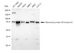 RSK2 Antibody in Western Blot (WB)