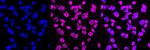 XPD Antibody in Immunocytochemistry (ICC/IF)