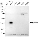 C4BPB Antibody in Western Blot (WB)