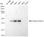 Creatine Kinase BB Antibody in Western Blot (WB)