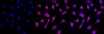 Alcohol Dehydrogenase 1A Antibody in Immunocytochemistry (ICC/IF)