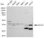 Alcohol Dehydrogenase 1A Antibody in Western Blot (WB)