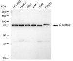 ALDH16A1 Antibody in Western Blot (WB)