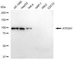 SERCA1 ATPase Antibody in Western Blot (WB)