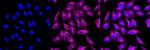 CaMKII Pan Antibody in Immunocytochemistry (ICC/IF)