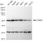 CaMKII Pan Antibody in Western Blot (WB)