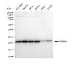 RAB8A Antibody in Western Blot (WB)