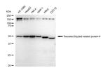 SFRP4 Antibody in Western Blot (WB)