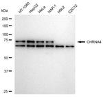 CHRNA4 Antibody in Western Blot (WB)