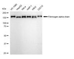 Fibrinogen alpha chain Antibody in Western Blot (WB)