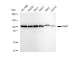 GART Antibody in Western Blot (WB)