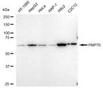 PMP70 Antibody in Western Blot (WB)