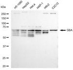 GBA Antibody in Western Blot (WB)