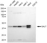 GALT Antibody in Western Blot (WB)