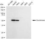 GCK Antibody in Western Blot (WB)