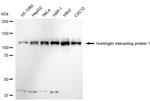 HIP1 Antibody in Western Blot (WB)