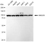 HMGCR Antibody in Western Blot (WB)