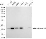 IFN beta Antibody in Western Blot (WB)