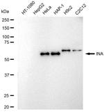 alpha Internexin Antibody in Western Blot (WB)