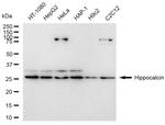 Hippocalcin Antibody in Western Blot (WB)