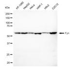 Fyn Antibody in Western Blot (WB)