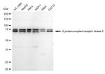 GRK6 Antibody in Western Blot (WB)