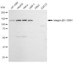 CD61 Antibody in Western Blot (WB)