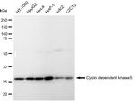 CDK5 Antibody in Western Blot (WB)