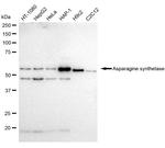 Asparagine Synthetase Antibody in Western Blot (WB)