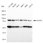 ACAP2 Antibody in Western Blot (WB)