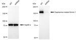 DIAPH1 Antibody